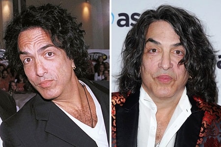 A picture of Paul Stanley before (left) and after (right).